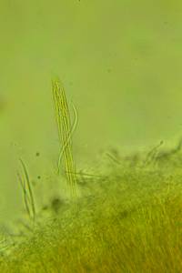 Coccomyces triangularis image