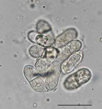 Rhabdocline pseudotsugae image