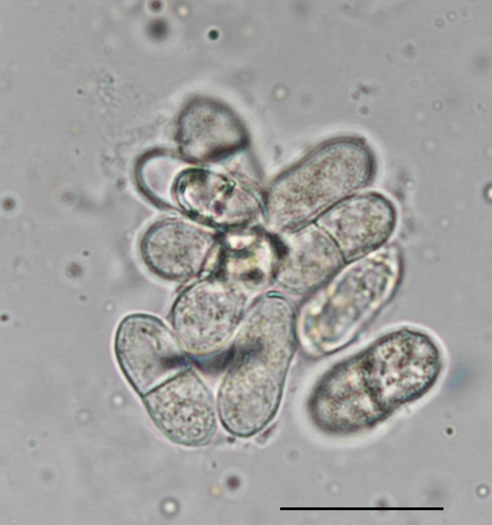 Rhabdocline pseudotsugae image