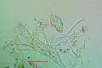 Scytinium biatorinum image