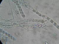 Tarzetta cupularis image