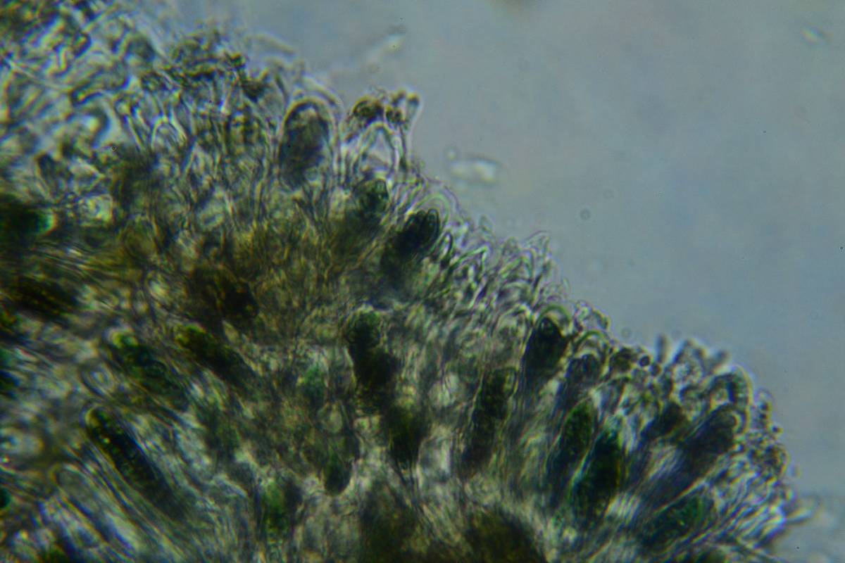Dactylospora image