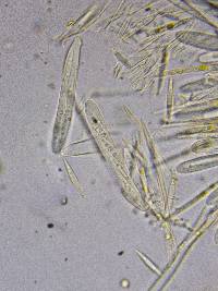 Lachnellula ellisiana image