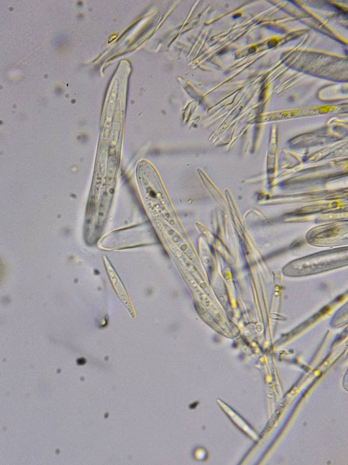 Lachnellula ellisiana image