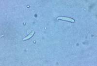 Mitrula lunulatospora image