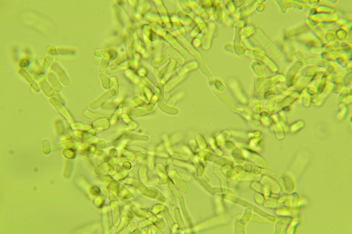 Laetisaria fuciformis image