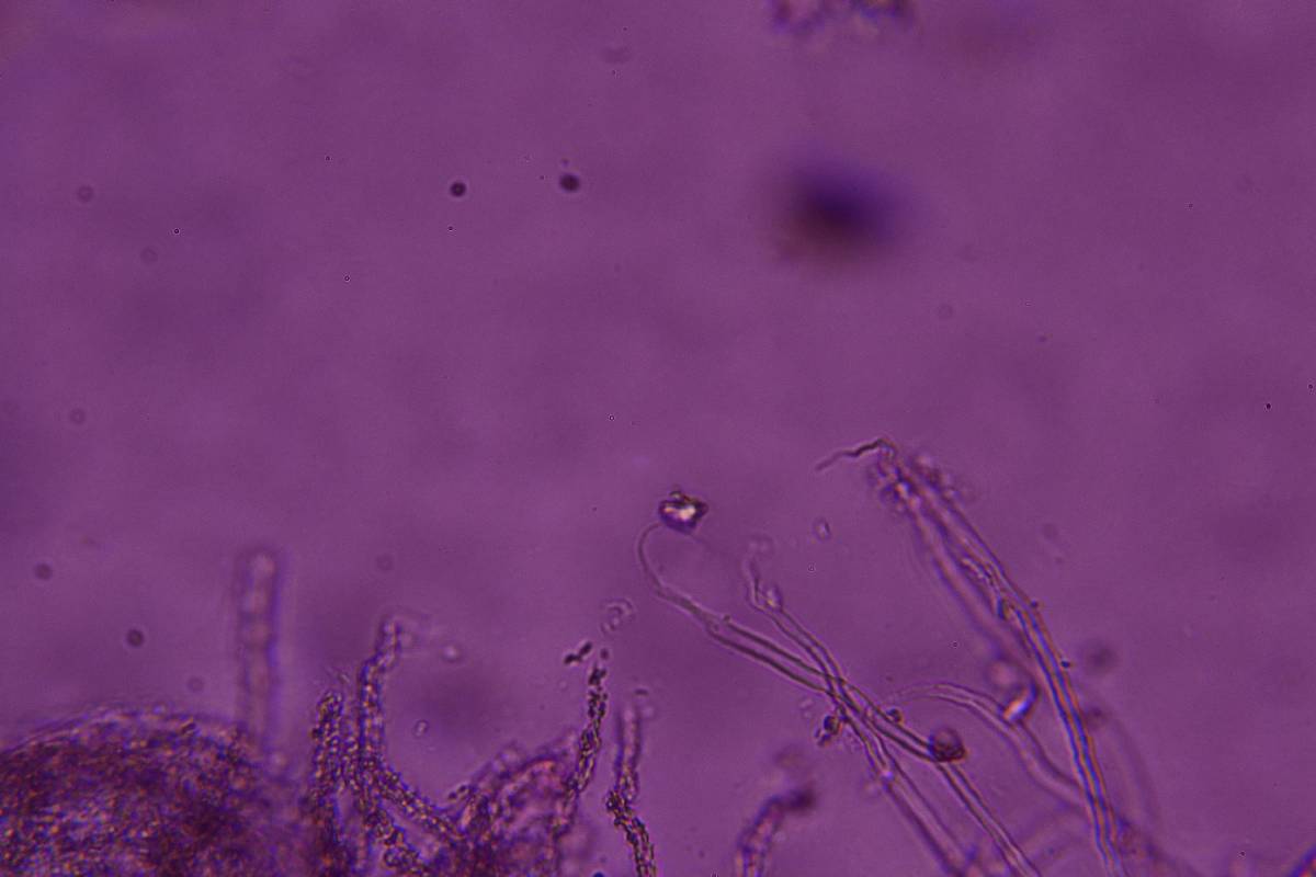 Flagelloscypha minutissima image