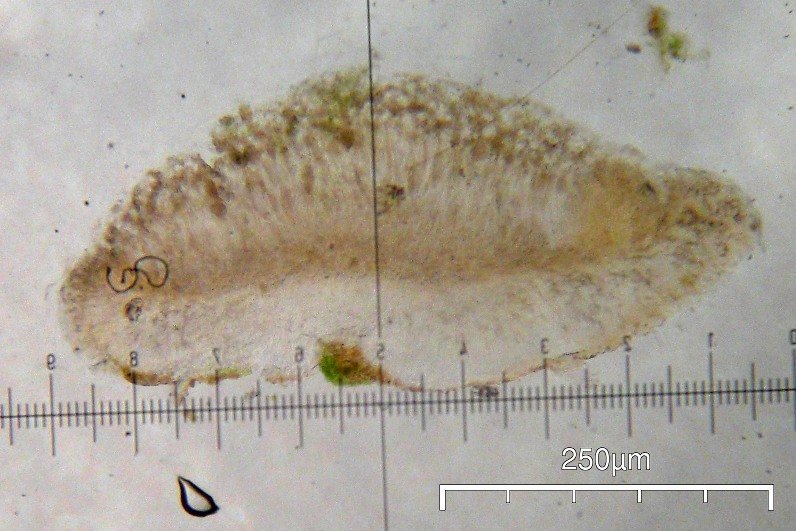 Bacidina image