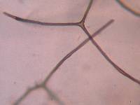 Lycoperdon molle image