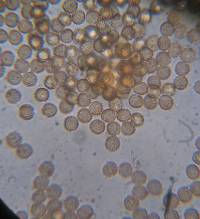 Reticularia lycoperdon image