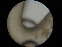 Pluteus nanus image