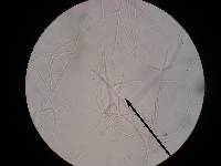 Tolypocladium longisegmentatum image