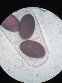 Ascobolus immersus image