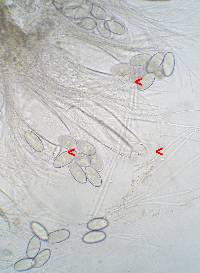 Ascobolus immersus image
