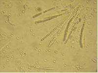 Hypocrea pulvinata image