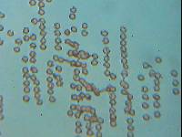 Lycogala epidendrum image