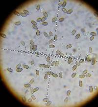 Psathyrella longistriata image