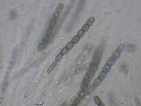 Thuemenella cubispora image