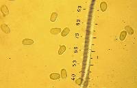Mycena strobilinoidea image