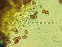 Psilocybe baeocystis image