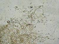 Coprinopsis semitalis image
