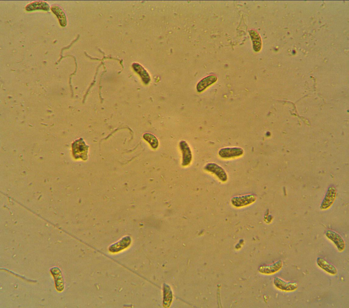 Exidia candida image