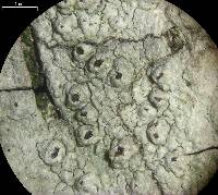 Pertusaria pustulata image