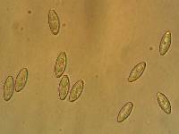 Byssonectria fusispora image