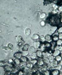 Ceratiomyxa fruticulosa var. fruticulosa image