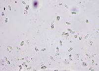 Anisomeridium biforme image