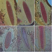 Pertusaria pertusa image