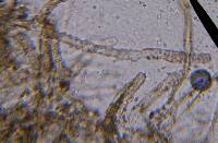 Tylopilus felleus image