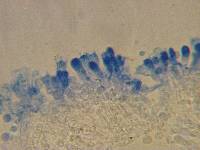 Gloeohypochnicium analogum image