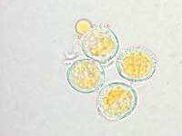 Chrysomyxa rhododendri image