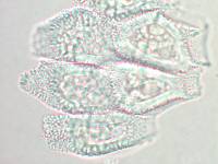 Aecidium ranunculi-lyallii image