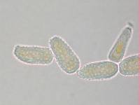 Melampsoridium betulinum image