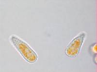 Melampsoridium betulinum image