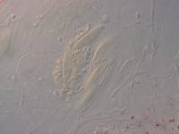 Dermatea fumosa image