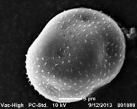 Puccinia porri image