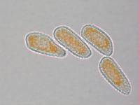 Melampsoridium betulinum image