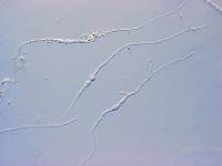 Mycosphaerella metrosideri image