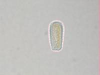 Melampsoridium betulinum image