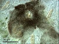 Mycosphaerella densa image