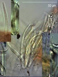 Septoria plantaginea image