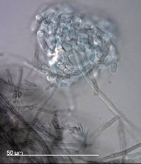 Pseudoclathrosphaerina spiralis image