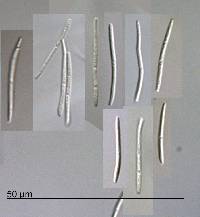 Septoria coprosmae image