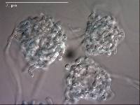 Pseudoclathrosphaerina spiralis image