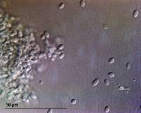 Pseudomicrostroma juglandis image