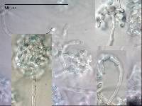 Pseudoclathrosphaerina spiralis image
