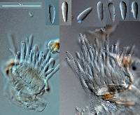 Ramularia rubella image